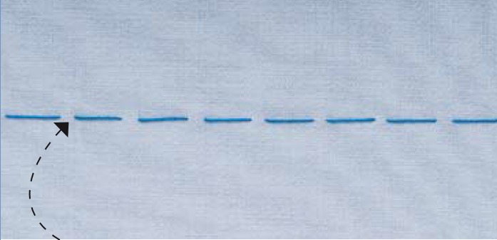 mũi khâu dài ngắn