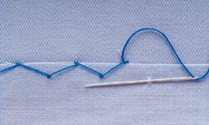 mũi khâu lượn sóng