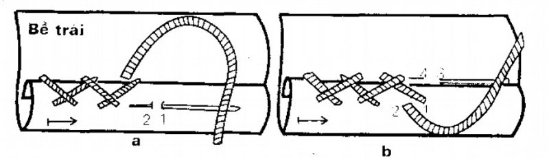 mũi vắt hàng rào